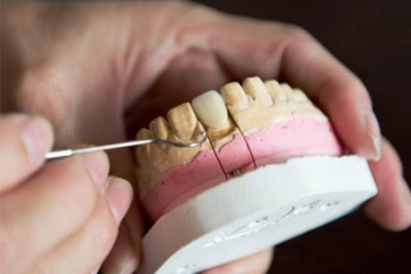 Зуб без кости. Наращивание зубной кости. Наращивание костной ткани зуба. Наращивание челюстной кости для имплантов.